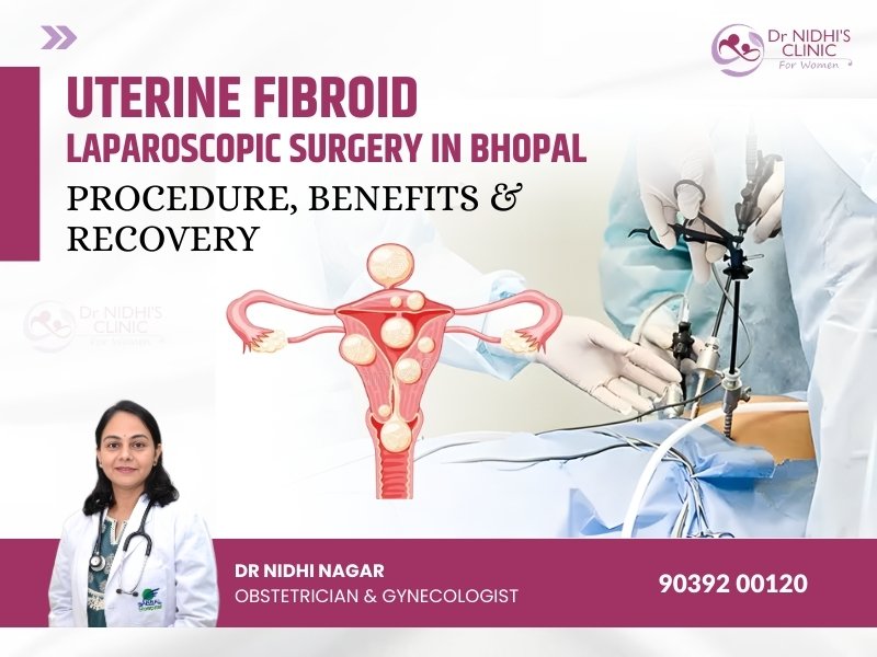 Uterine Fibroid Laparoscopic Surgery in Bhopal – minimally invasive fibroid treatment by Dr Nidhi Nagar, best gynecologist in Bhopal