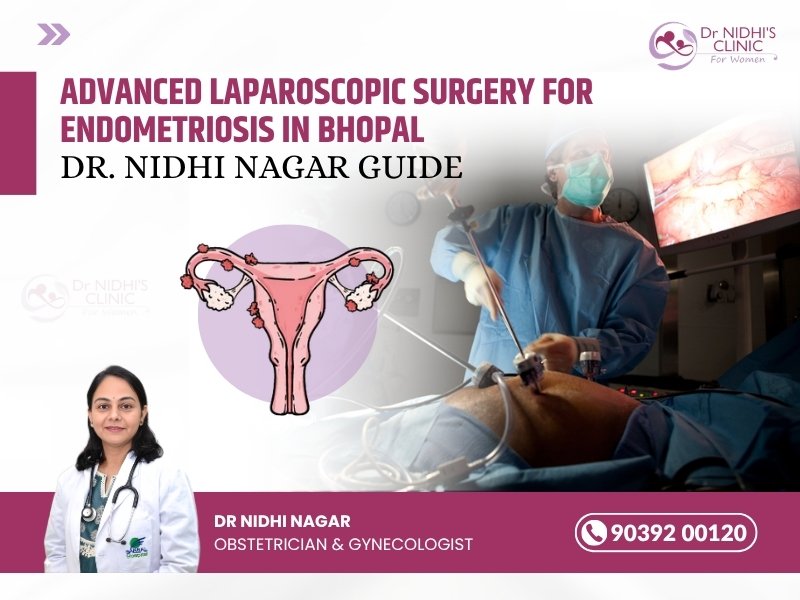 Advanced Laparoscopic Surgery for Endometriosis in Bhopal by Dr. Nidhi Nagar – Best Gynecologist in Bhopal